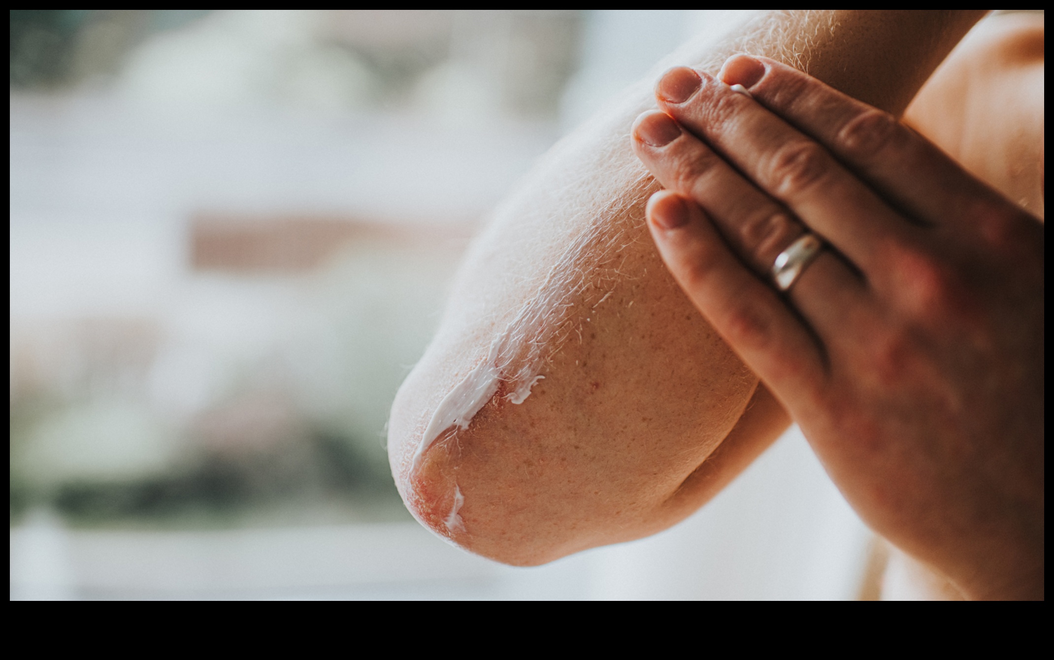 Vegānisms un ādas stāvokļi: augu bāzes risinājumi